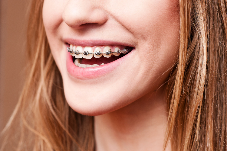 Orthodontist in Thorneside
